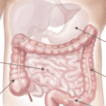 Native Americans Face Highest Mortality from Digestive Diseases