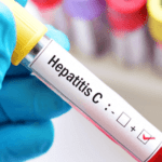 Racial Disparities Persist in Hepatitis C Testing